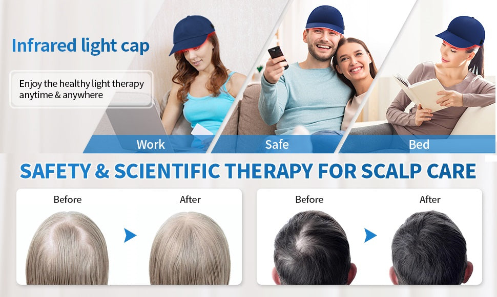 Does Red Light Therapy Work for Hair Loss? Unlocking the Secrets to Regrowing Your Hair