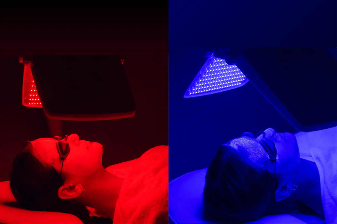 Red Light Therapy vs. Blue Light Therapy: Unveiling the Science Behind These Powerful Light Treatments