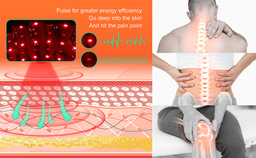 Red Light Therapy for Arthritis: A Comprehensive Guide to Relief and Recovery