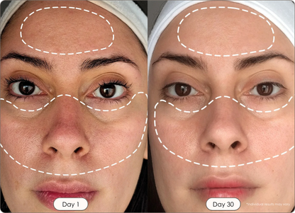 Infrared Red & Blue Light Mask for Face